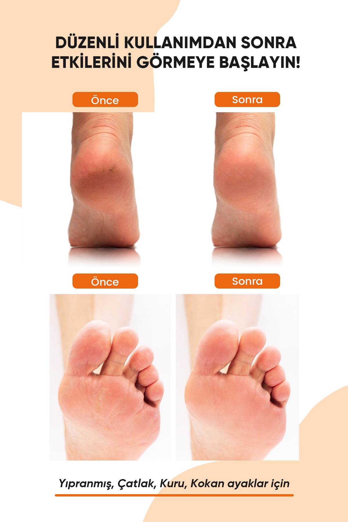 ROYUES Topuk Çatlak ve Ayak Bakım Spreyi - Koku Giderici ve Nemlendirici Spreyi - Foot Care Sprey
