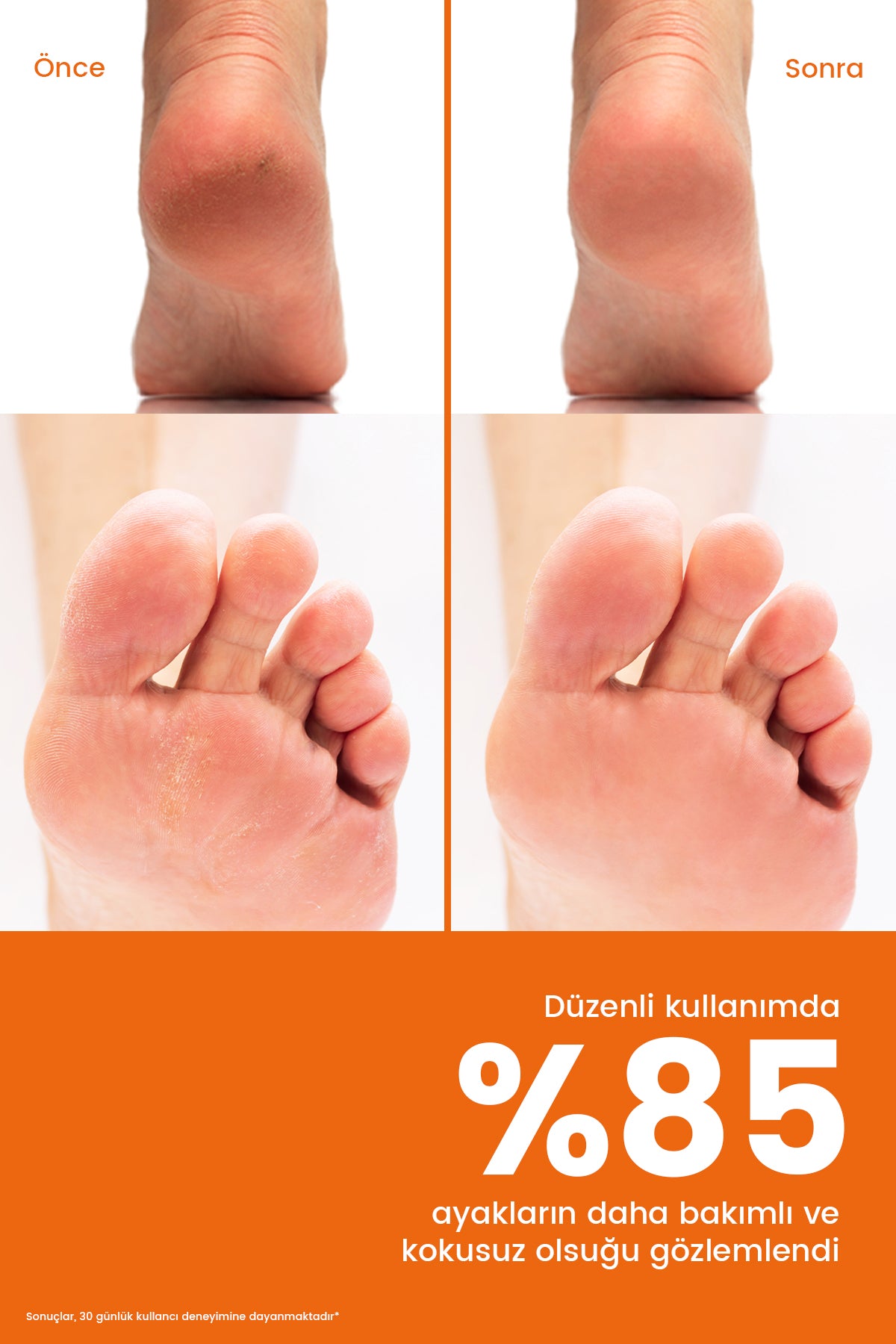 ROYUES Topuk Çatlak ve Ayak Bakım Spreyi - Koku Giderici ve Nemlendirici Spreyi - Foot Care Sprey
