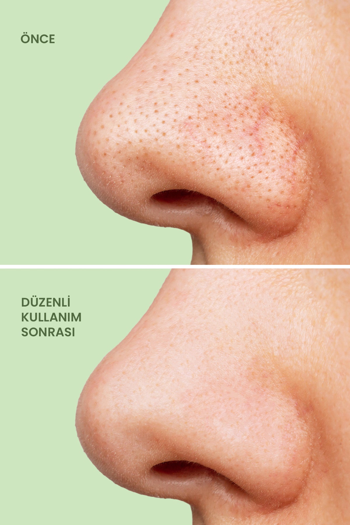 ROYUES Kolajen Kil Maskesi - Leke Ve Siyah Nokta Giderici Yüz Maskesi - Collagen Clay Mask