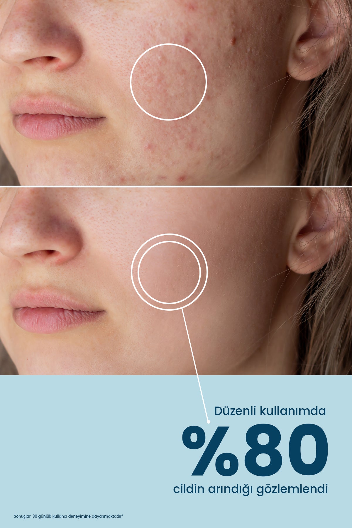 ROYUES Yeşil Çay Özlü Yüz Temizleme Jeli, Canlandırıcı, Nemlendirici, Arındırıcı, Facial Cleasing Gel 200ml