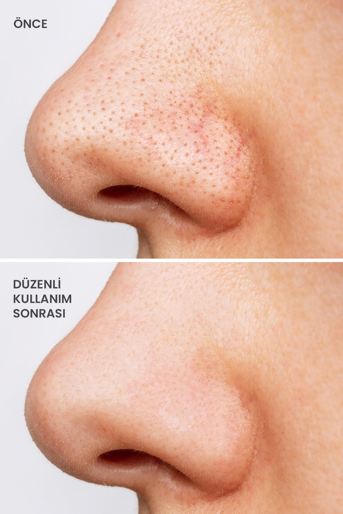 ROYUES Kolajen Kil Maskesi - Leke Ve Siyah Nokta Giderici Yüz Maskesi - Collagen Clay Mask
